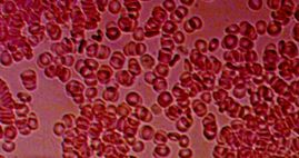 Blood Cells under Microscope